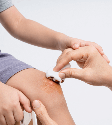 Tips for Proper Healing