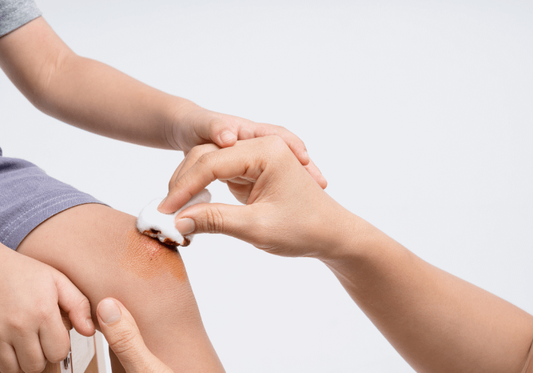 Tips for Proper Healing